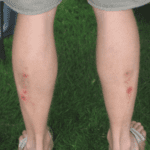 Rowers calves