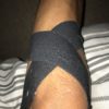 Strapping tape , knee injury, Tape support