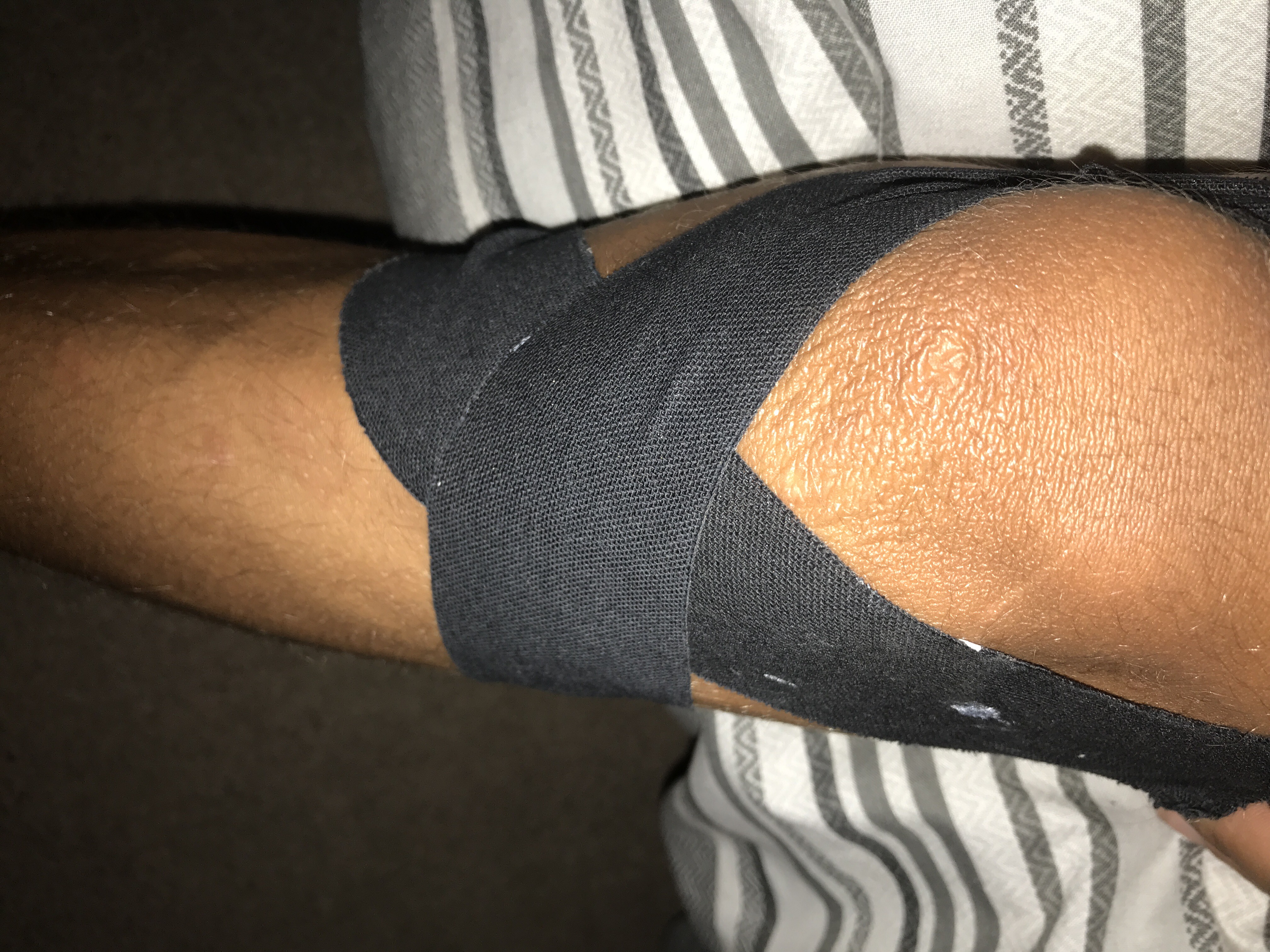 Rowing Knee strapping with D3 tape
